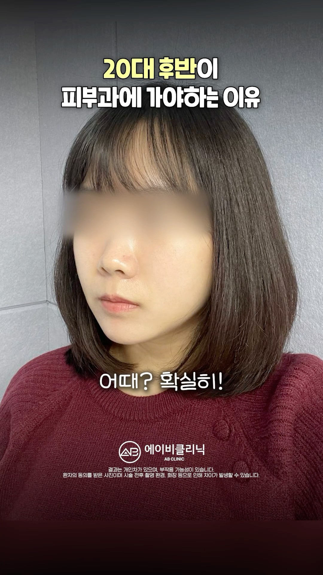 20대 후반부터 피부과 찾는 이유