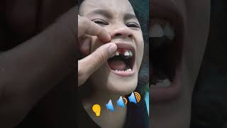 Download lagu ASMR RUNTUHNYA GIGI SUSU PERTAMA (cek kolom komentar) mp3 Download lagu ASMR RUNTUHNYA GIGI SUSU PERTAMA (cek kolom komentar) mp3