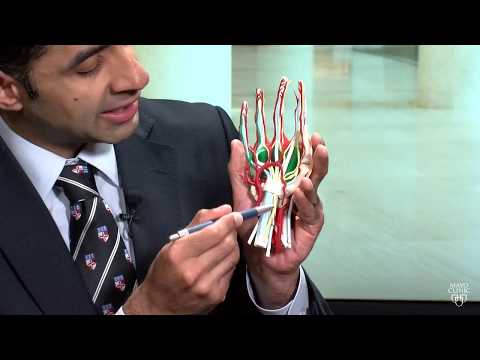 Mayo Clinic Minute: What is carpal tunnel syndrome?