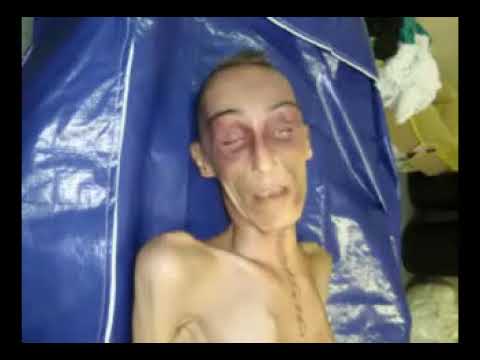 video frame placeholder