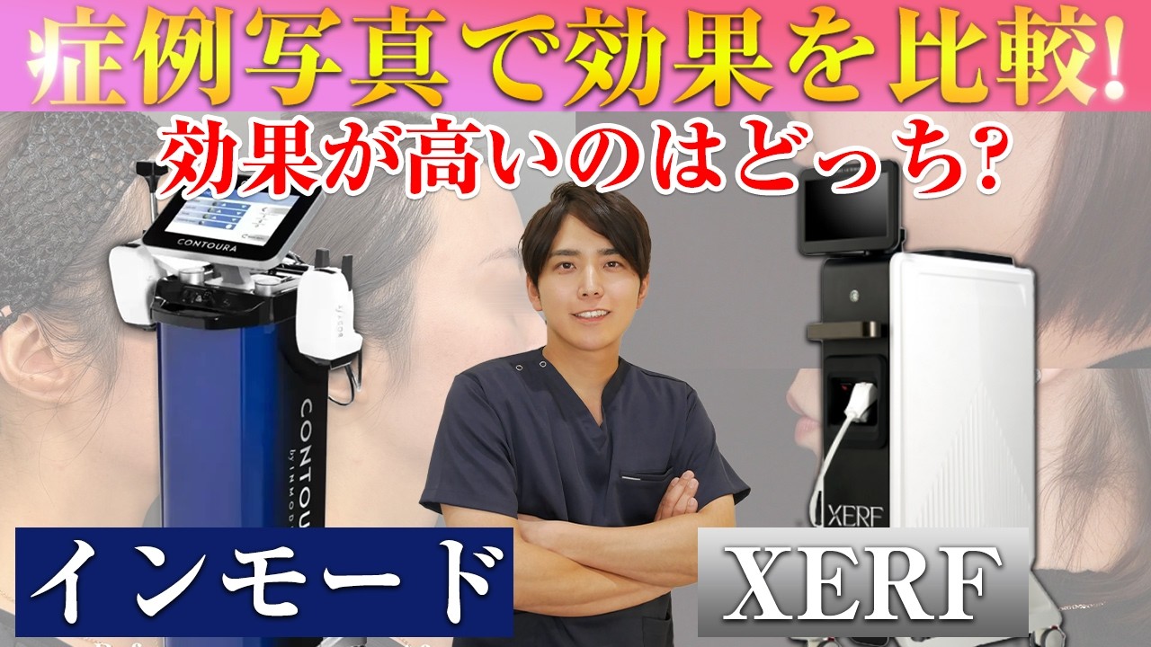 インモードリフトとXERF(ザーフ)どっちの方が効果が高い？メリットデメリットを徹底比較！