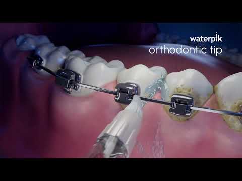 Waterpik™ Orthodontic Tip