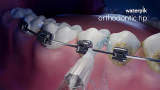 Waterpik Waterpik™ Orthodontic Tip