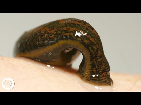 WATCH: See How Leeches Can Be A Surgeon's Sidekick