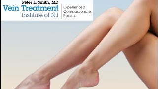 preview picture of video 'Make Varicose Veins Disappear Bayonne, Painless Vein Treatment by Dr Peter Smith Vascular Surgery'