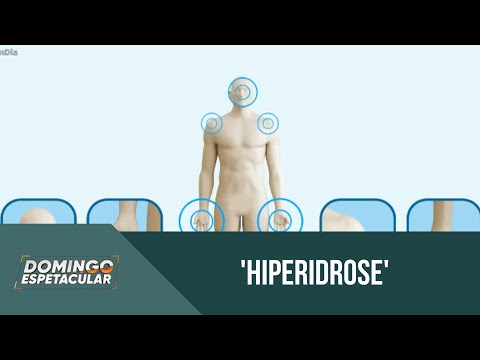 Você e o Doutor: Veja o que pode levar ao suor excessivo e como combater esse problema