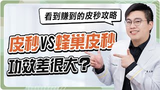 打造媽生美肌靠「皮秒雷射」？告別黑斑、痘疤