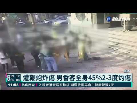 進香團燃鞭炮 香客遭炸成2-3度灼傷