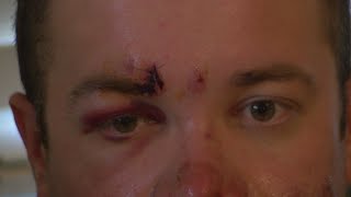 Airman thankful to be alive after hit and run motorcycle crash