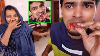 I CUT MY TONGUE..😛 (PRANK) PAMI SHOUTED..😆😆