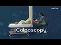 Colposcopy | Medical Procedure | 3d Animation Video |