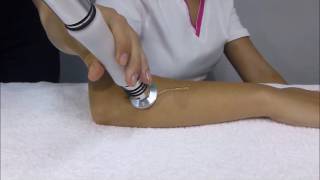 Ondas de Choque CEC. Tratamiento para Epicondilitis.