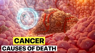 Wie stirbt ein Mensch an Krebs? Chirurg reagiert