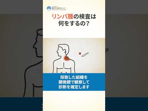 リンパ節腫脹について詳しく解説