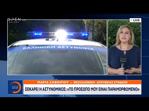 Σοκάρει η αστυνομικός: Το πρόσωπό μου είναι παραμορφωμένο | Μεσημεριανό Δελτίο Ειδήσεων | OPEN TV