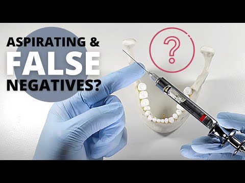 What Most Dentists Don't Know About Aspirating 