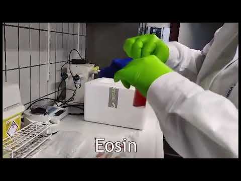 Blood smear and Diff-Quick staining