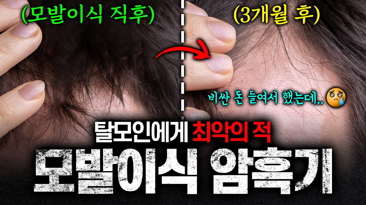 더원츠의원 유튜브