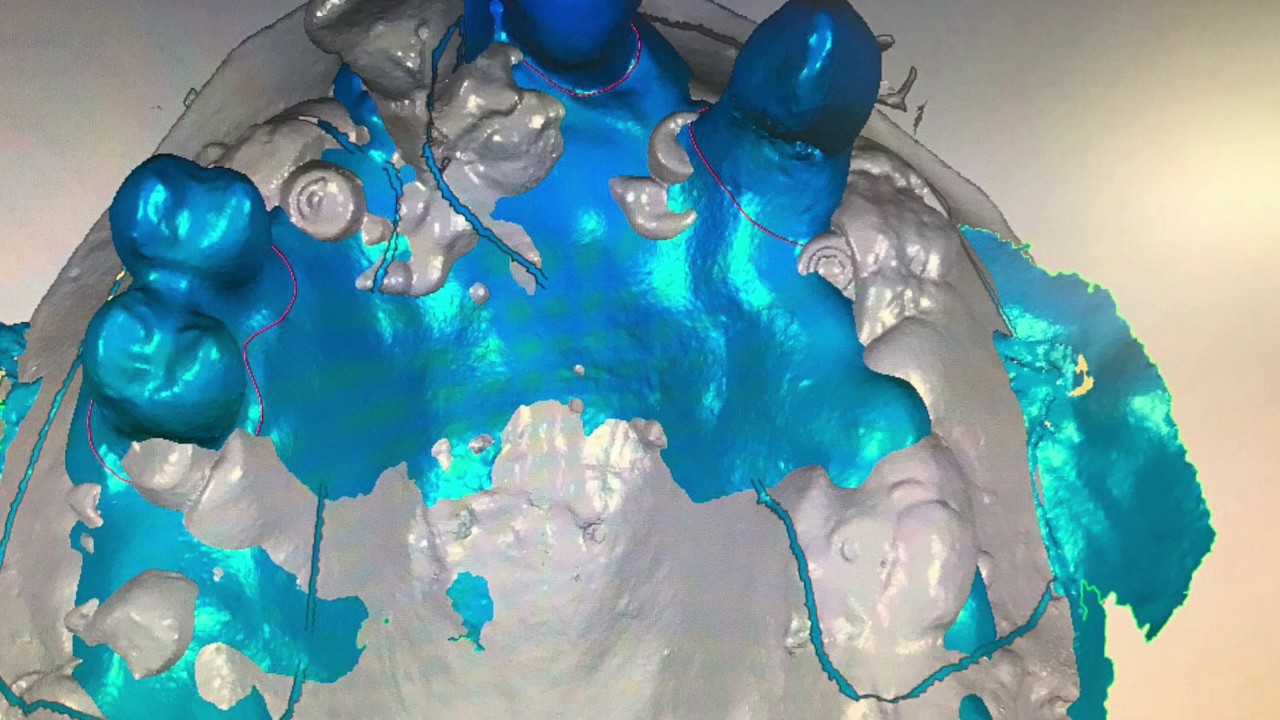 Antonio Bowen Antolín-11