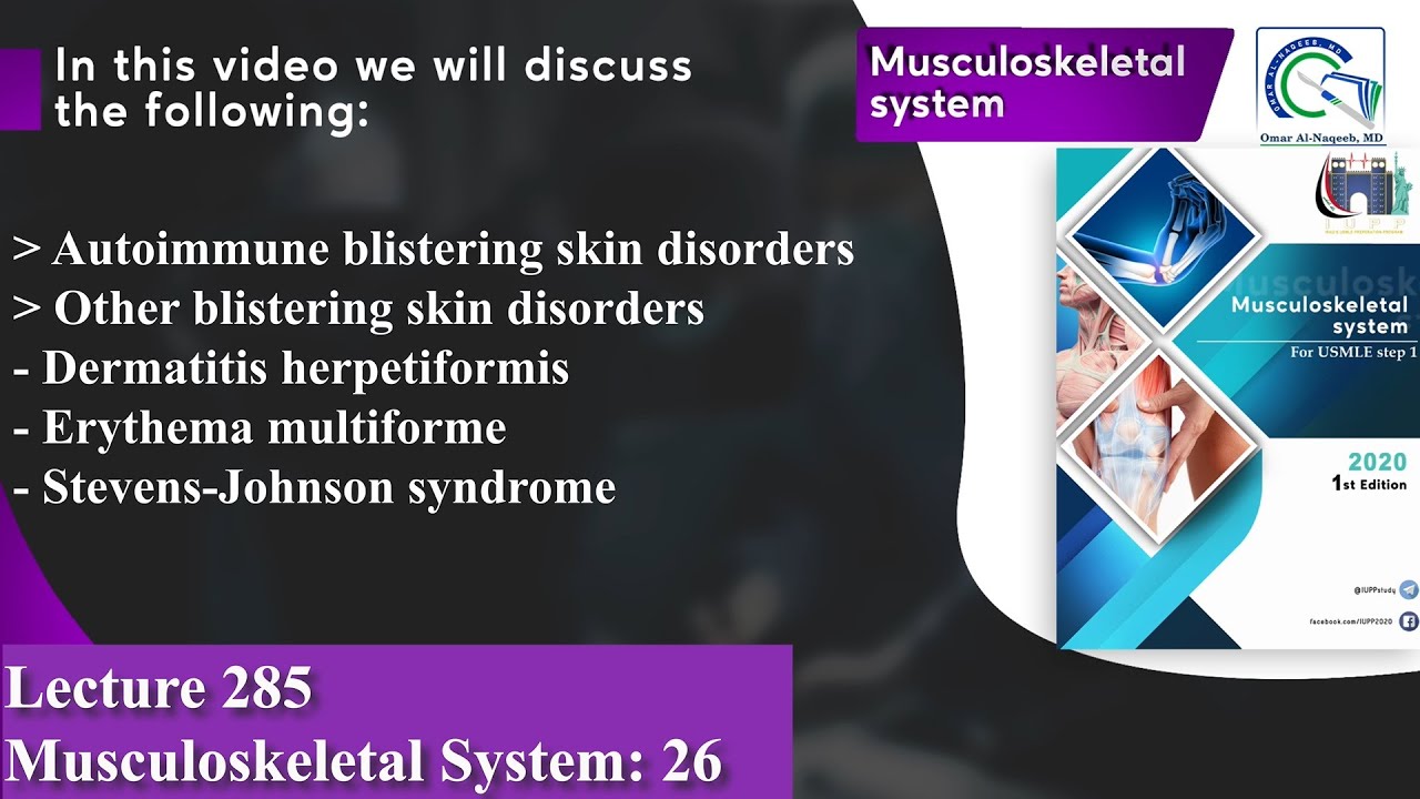 Pemphigus vulgaris | Bullous pemphigoid | Erythema multiforme | Stevens-Johnson syndrome