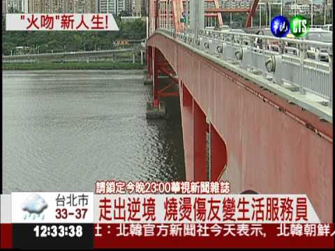 我懂你的痛... 燒燙傷友變志工