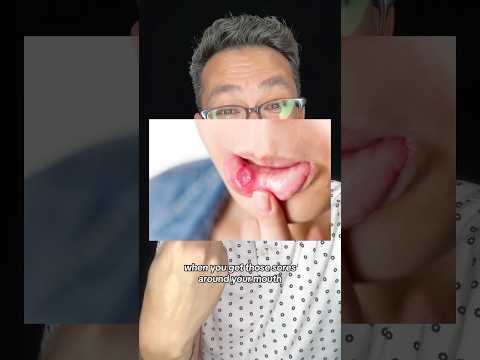 Three Tips if you're about to get Braces