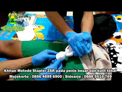 Siapa impotensi Apakah impotensi alikaps