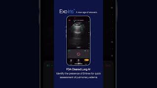 Lung AI FDA-Cleared