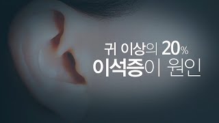 세상이 빙글빙글 돌고 구토까지? 뇌졸중 아닌 '이석증' [건강플러스] 미리보기