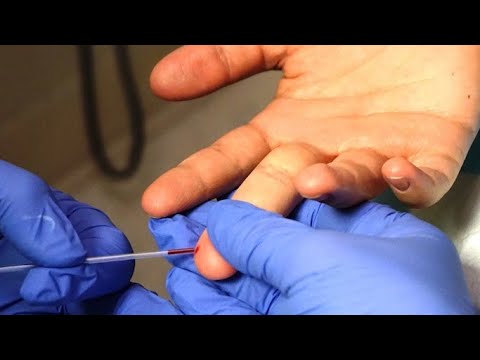 Quest Lead Test