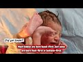 Breech Newborn S First Cry A Remarkable Beginning