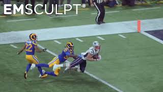 Emsculpt with Rob Grownkowski tight end for the Tampa Bay Buccaneers, former New England Patriot.