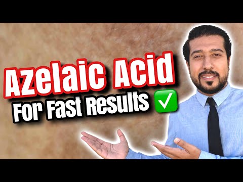 Azelaic Acid for Melasma | How to Use Azelaic Acid for SUCCESS 🏆