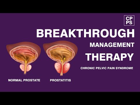 A prostatitis rák fázisa a férfiakban