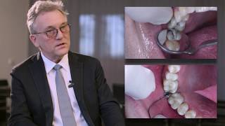 Step-by-step: Posterior restorations using Venus Diamond [EN]