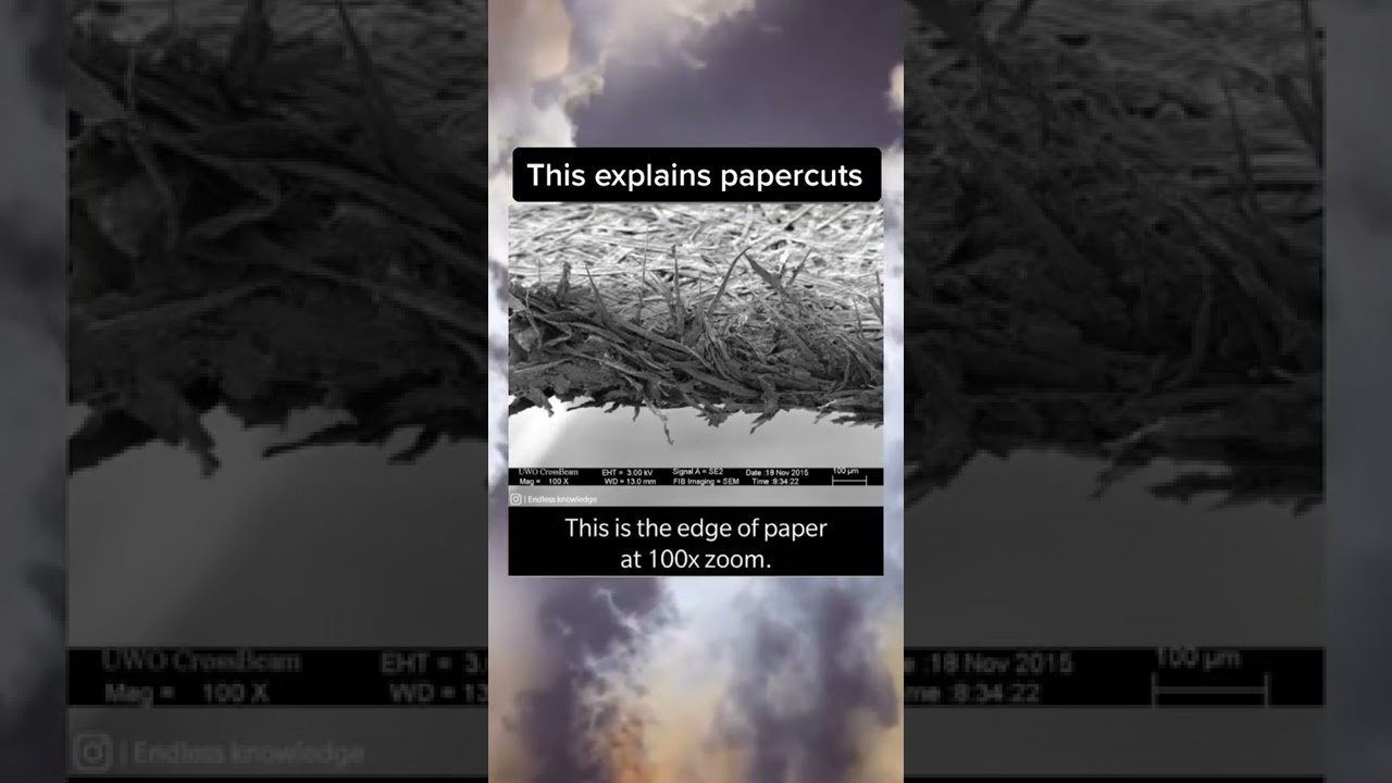 This explains it #shorts