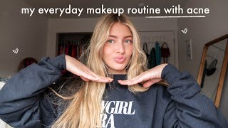 my everyday makeup routine with acne (while on acc