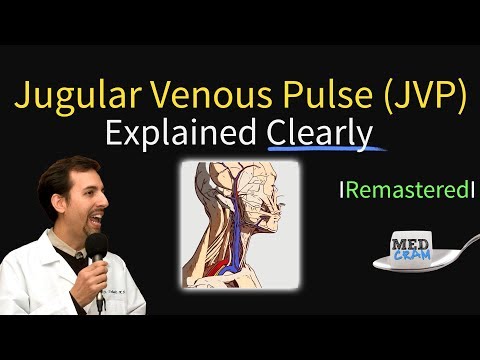 Jugular Venous Pulse (JVP) - Waveforms & Evaluation for JVD