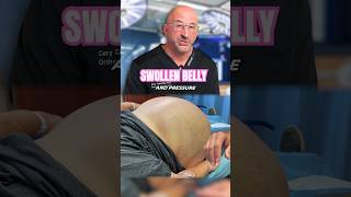 Watch Belly Drained of 5 Gallons of Fluid #shorts