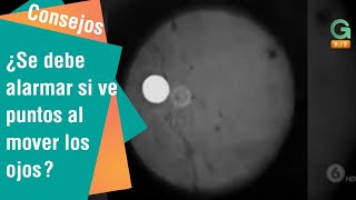 ¿Se debe alarmar si ve puntos al mover los ojos | Consejos para usted
