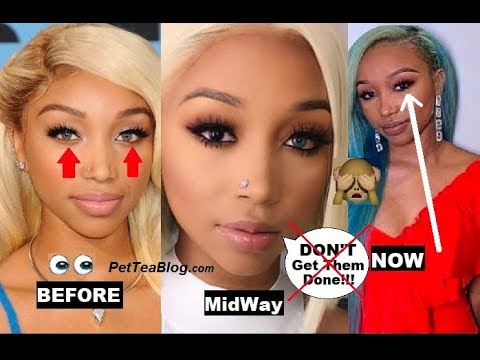 Zonnique Regrets Eye Color Change, Removed Both Blue Eyes after BLiND Scare 👁️