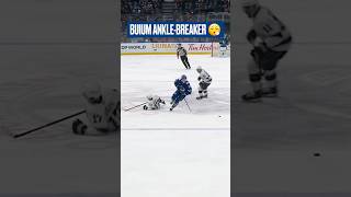 BUIUM, there goes your ankles. ????