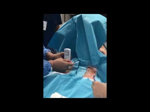 Training pronto soccorso - Sonda ecografica wireless OTE