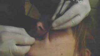 ~Nat's piercing delemma~