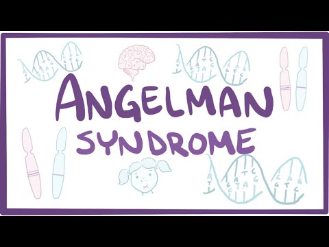 Angelman syndrome - causes, symptoms, diagnosis, treatment, pathology