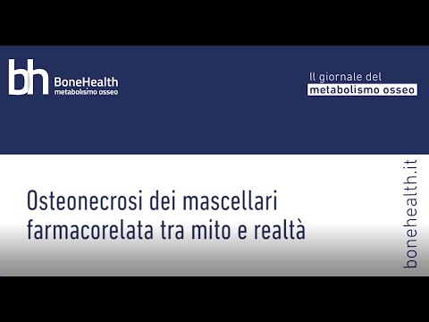 Osteonecrosi dei mascellari - intervista di BoneHealth a Tiziano Testori