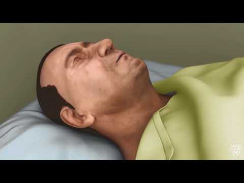 What happens during obstructive sleep apnea?