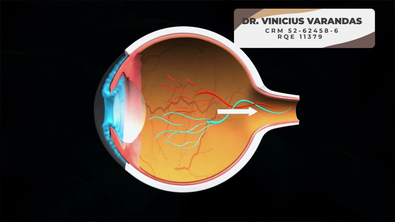 Vinícius Da Silva Varandas-10
