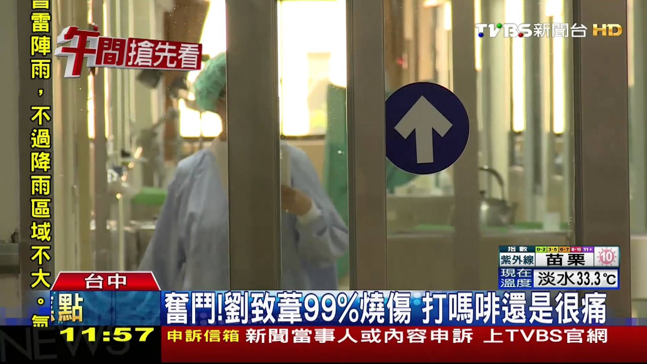 奮鬥!劉致葦99%燒傷 打嗎啡還是很痛