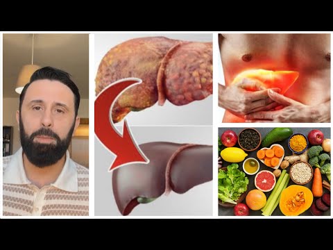 4 hapa për pastrimin e mëlçisë së dhjamosur nga Altin Joka/ Si të kuptoni problemet me mëlçinë…